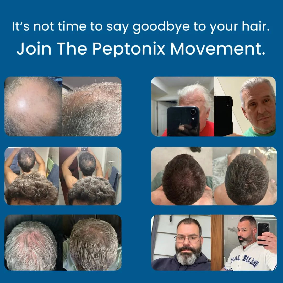 Peptonix - The Most Powerful Peptide Infusion  Hair Regrowth System